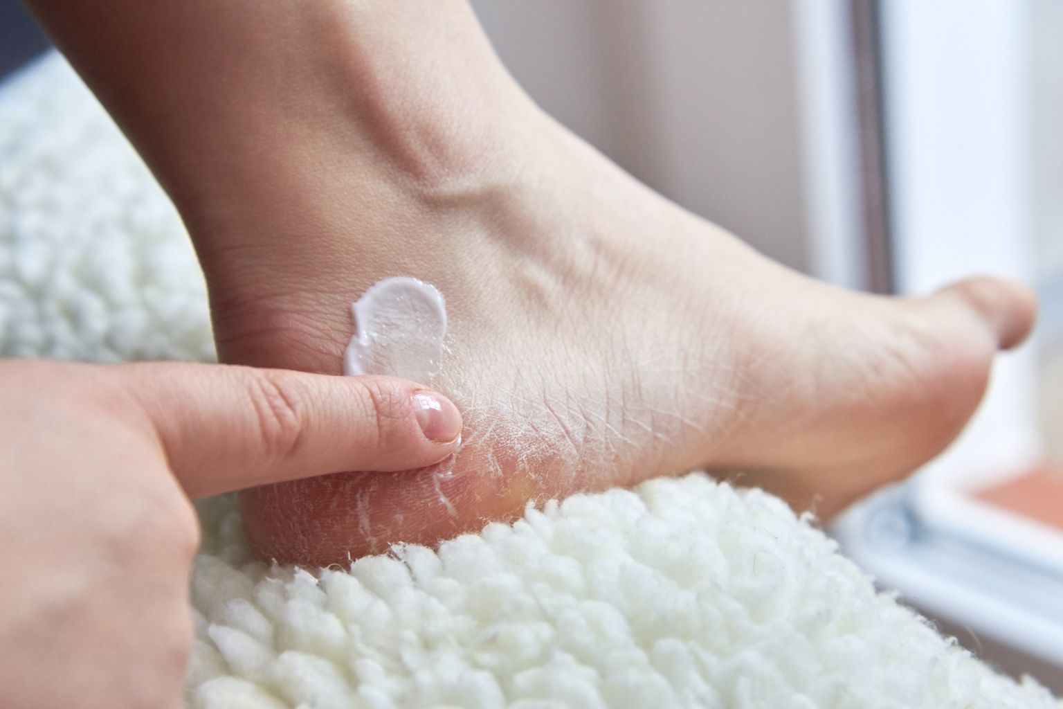 Piedi secchi: ecco cause e rimedi