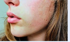 Pelle secca e stressata dagli agenti atmosferici: ecco i nostri prodotti must-hav